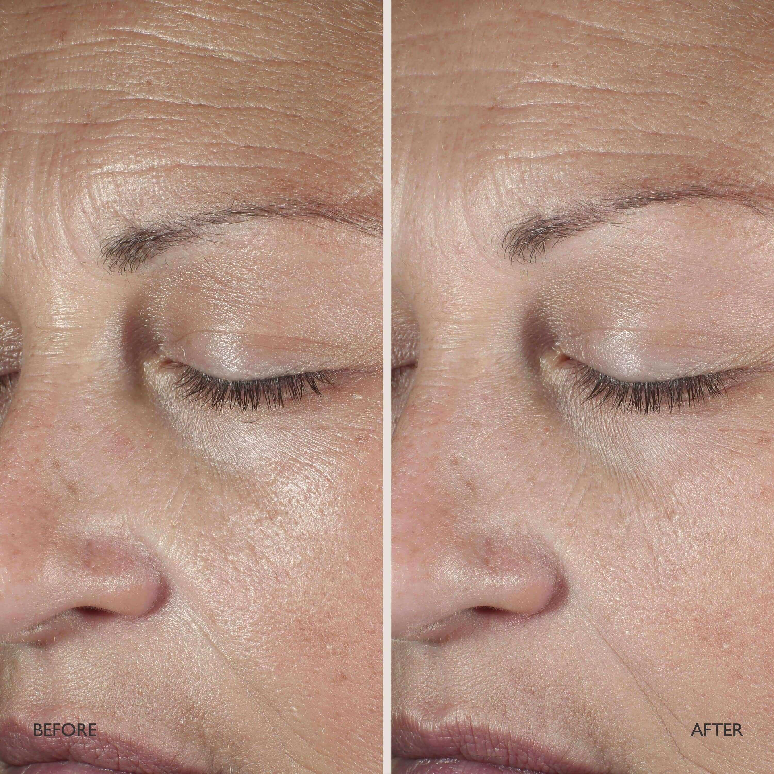 Queen Serum - Image 7